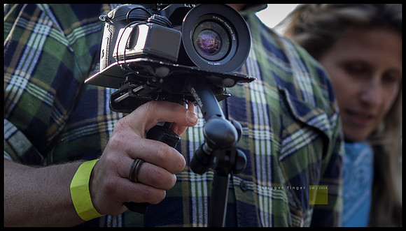 trigger finger